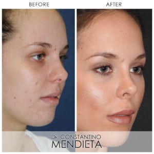 Before and After Image