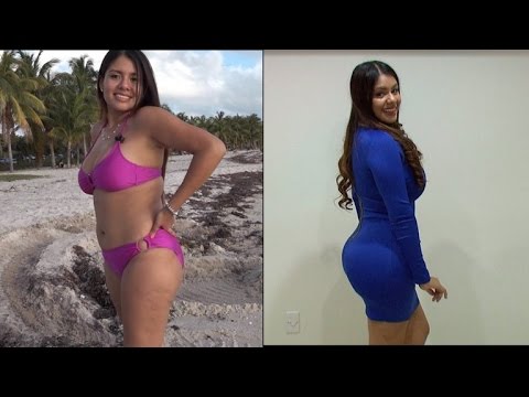 positive effects of plastic surgery