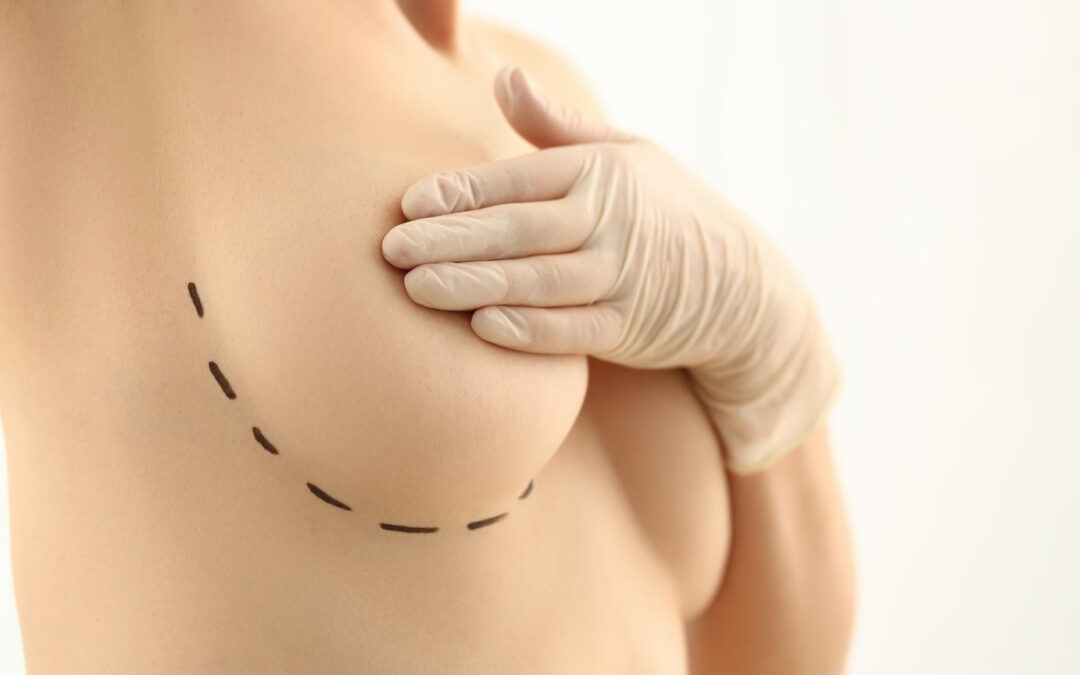 Plastic Surgery in Miami | The Cosmetic Procedure Hub