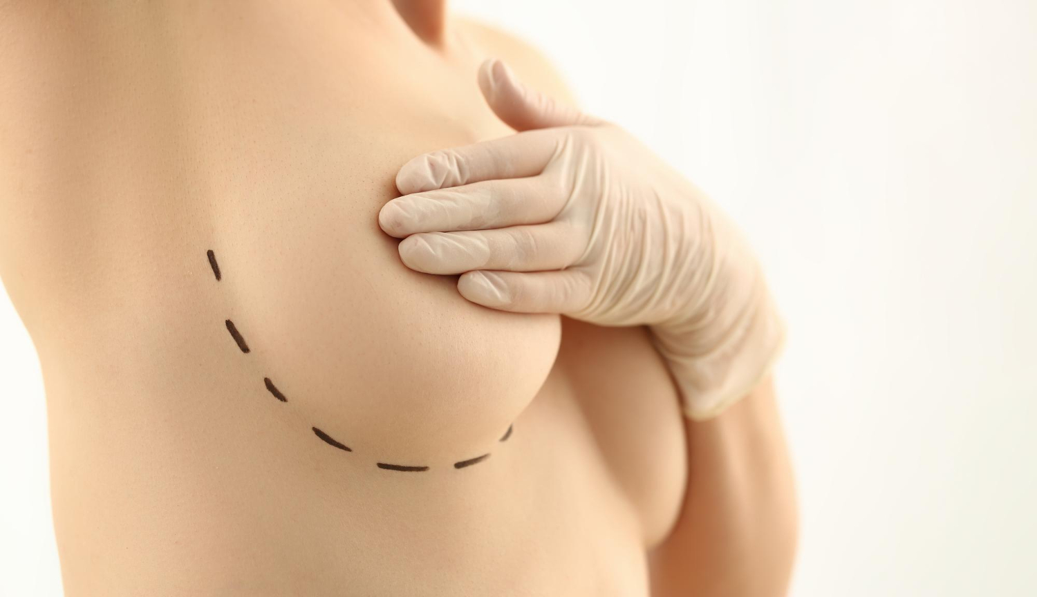 Plastic Surgery in Miami | The Cosmetic Procedure Hub