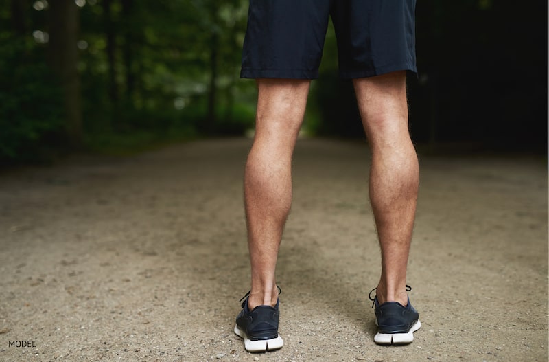 Why Are Calf Augmentations on the Rise?