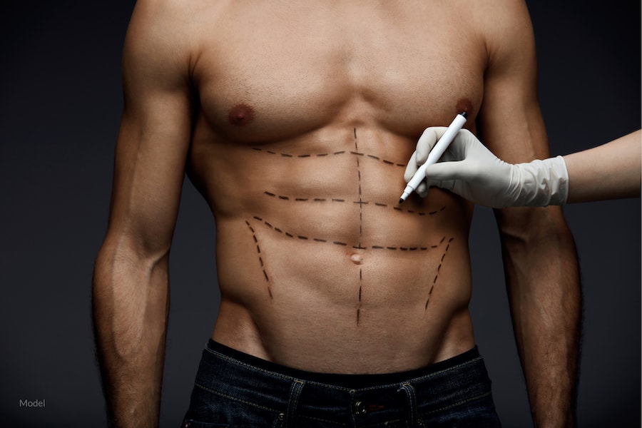 5 Reasons Why More Men Are Getting Plastic Surgery