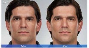 Before and After Image