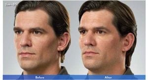 Before and After Image