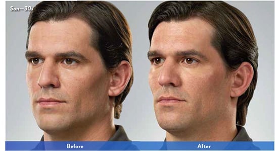 Before and After Image