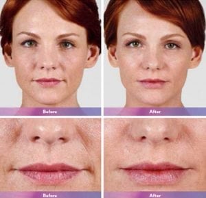 Before and After Image