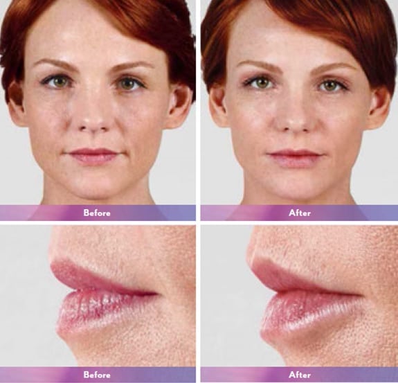 Before and After Image