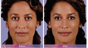 Before and After Image