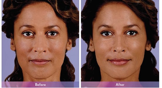 Before and After Image