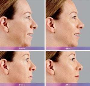 Before and After Image