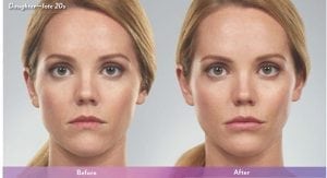 Before and After Image