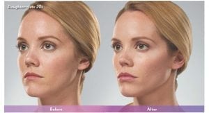 Before and After Image