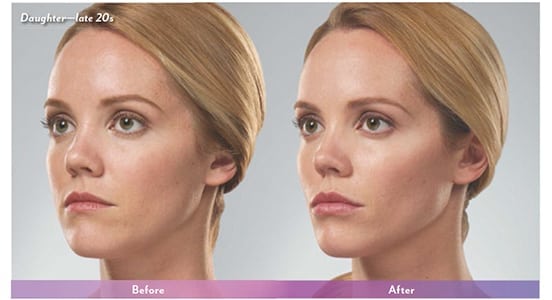 Before and After Image