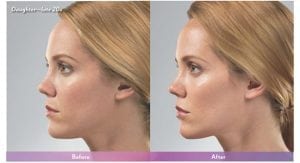 Before and After Image