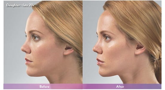 Before and After Image