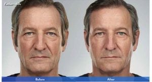 Before and After Image