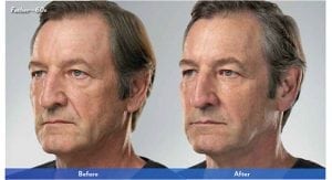 Before and After Image
