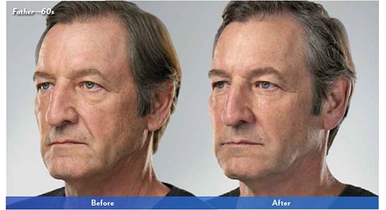 Before and After Image