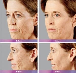 Before and After Image