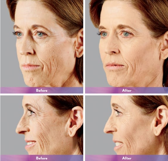 Before and After Image