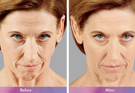 Before and After Image