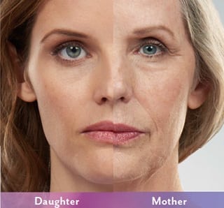 Before and After Image