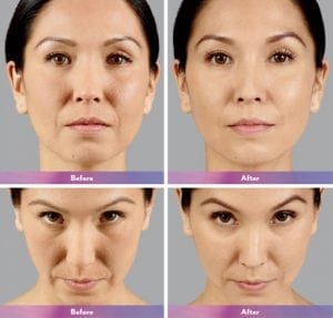 Before and After Image