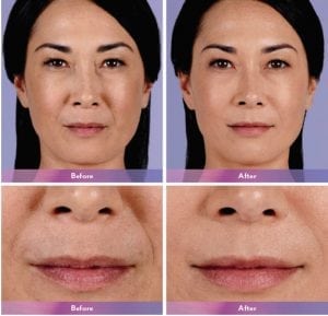 Before and After Image