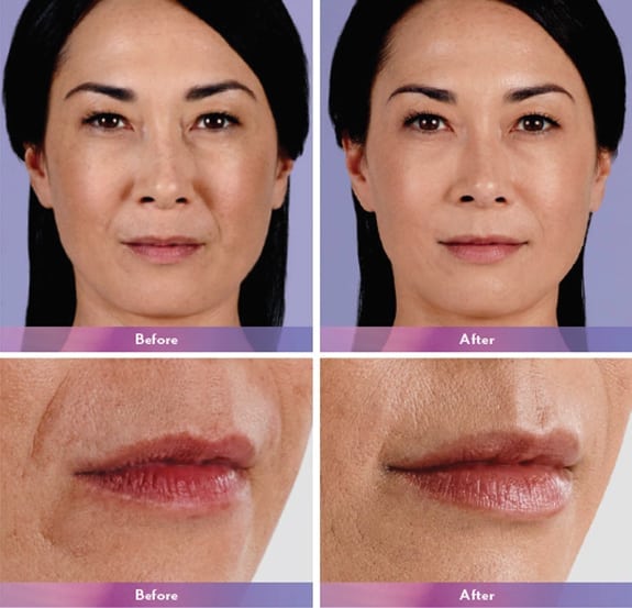 Before and After Image