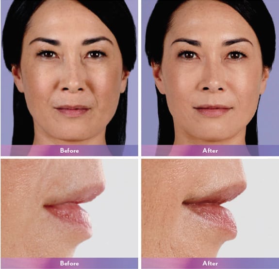 Before and After Image