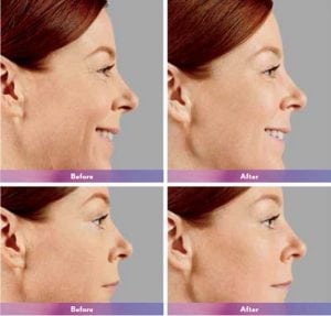 Before and After Image