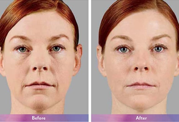 Before and After Image