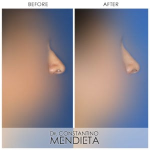 Before and After Image