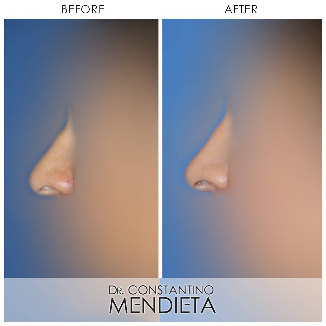 Before and After Image