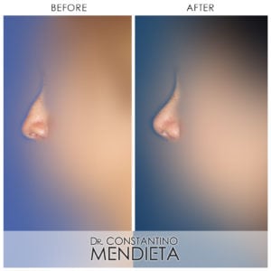 Before and After Image