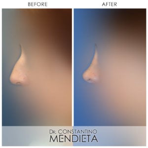 Before and After Image