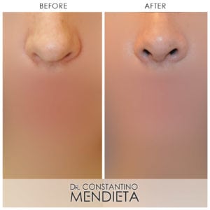 Before and After Image