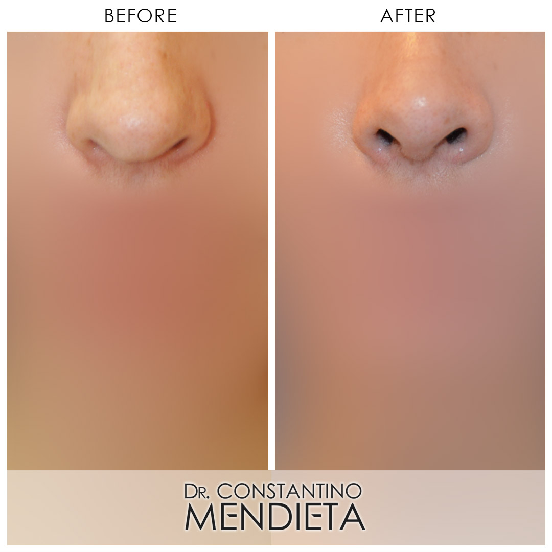 Before and After Image