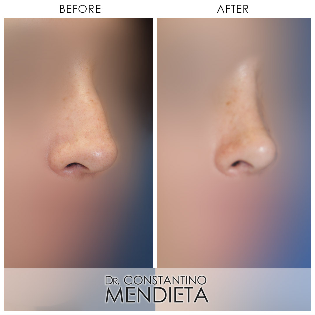 Before and After Image