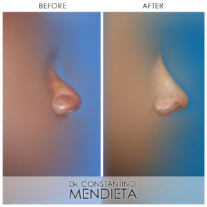 Before and After Image