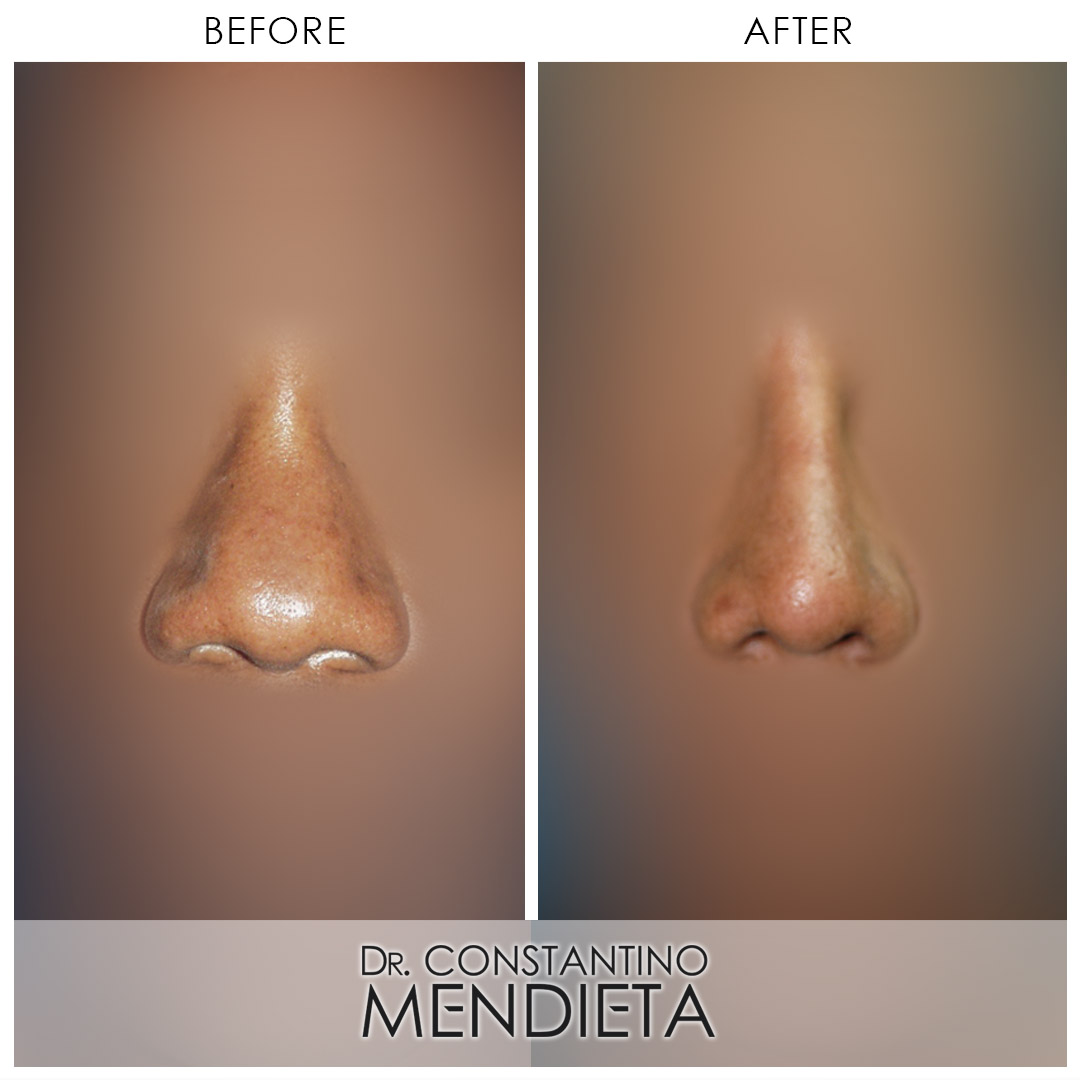 Before and After Image