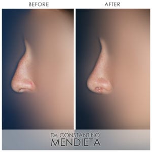 Before and After Image