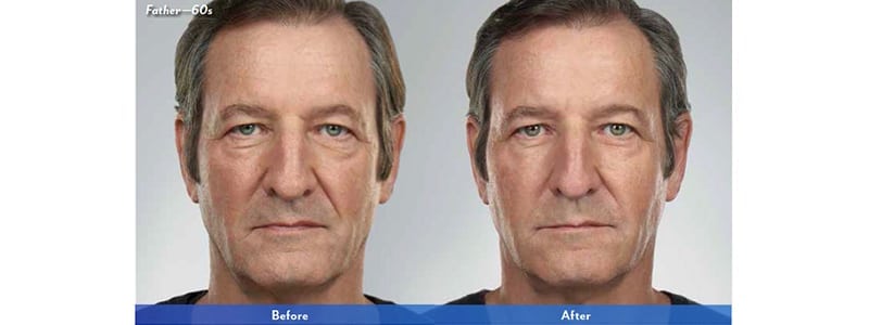 Before and After Image