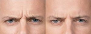 Before and After Image