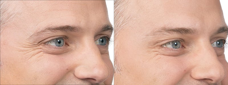 Before and After Image