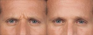 Before and After Image