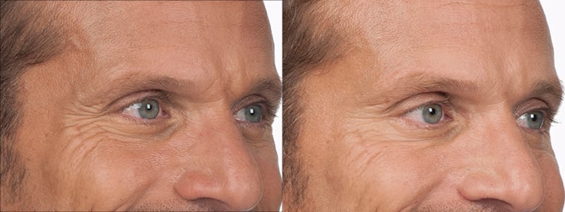 Before and After Image