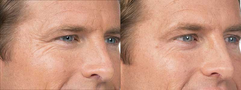 Before and After Image