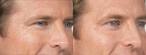 Before and After Image