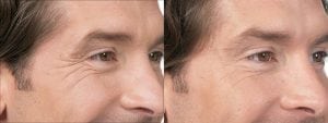 Before and After Image